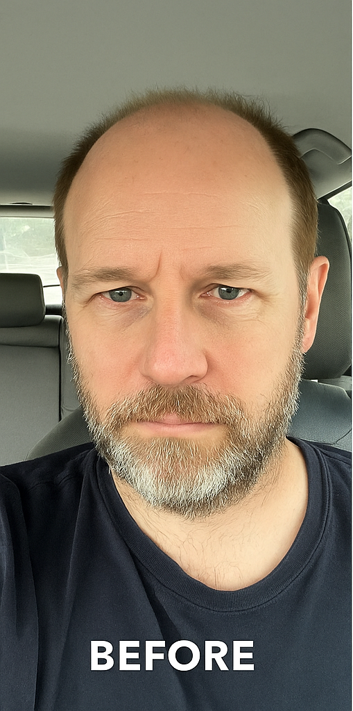 Dark Walnut Super Thin Skin V-looped 0.06mm